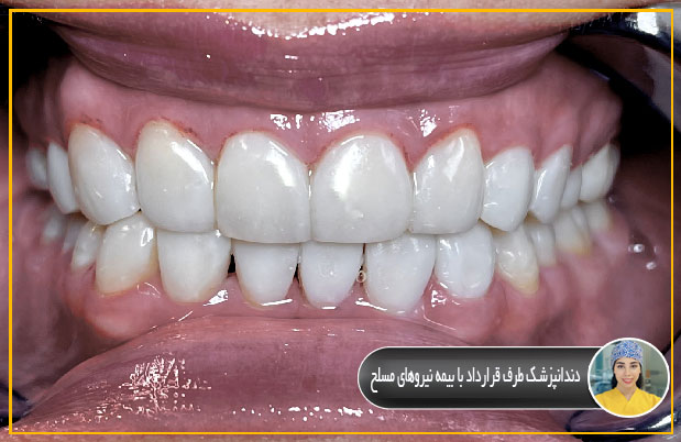 دندانپزشکی طرف قرارداد نیروهای مسلح شرق تهران
